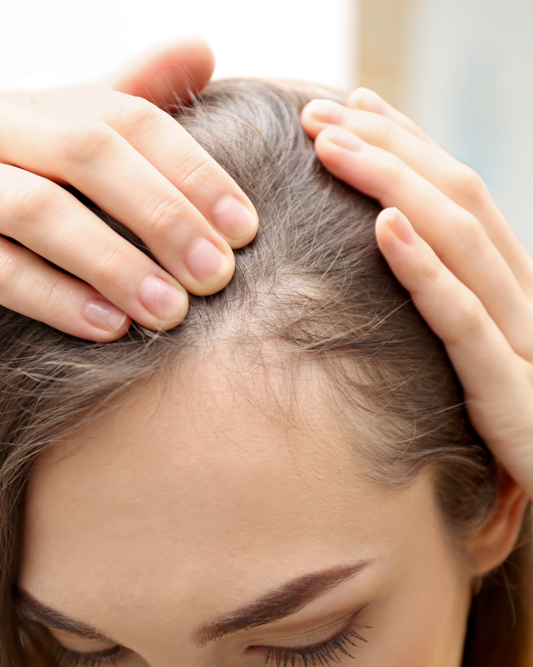 Hair Loss Awareness: What You Need to Know and How to Advocate for Your Health