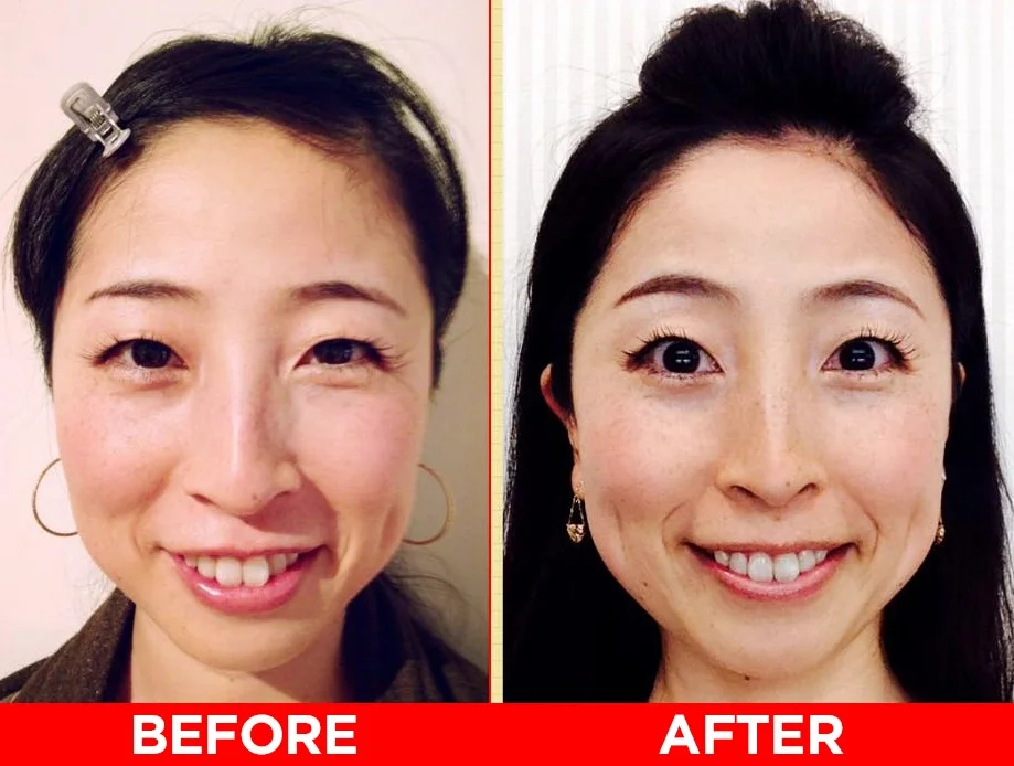 nagisa-before-after.jpg