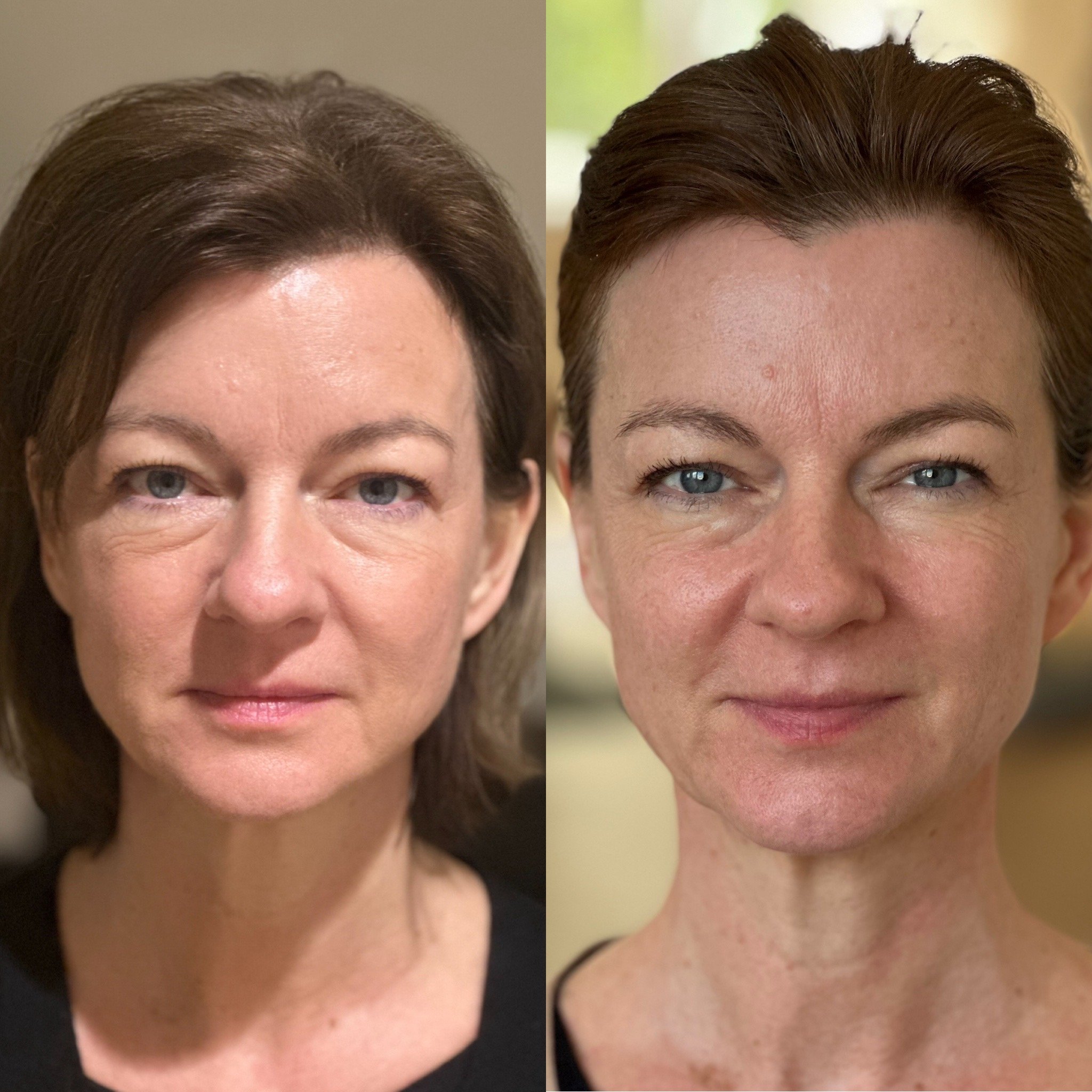 Katja Fischer nach 8 Wochen Modul 1 / Modul 2 und 3