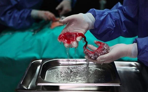Circumventive Organs by Agi Haines, 2013, (c) The artist