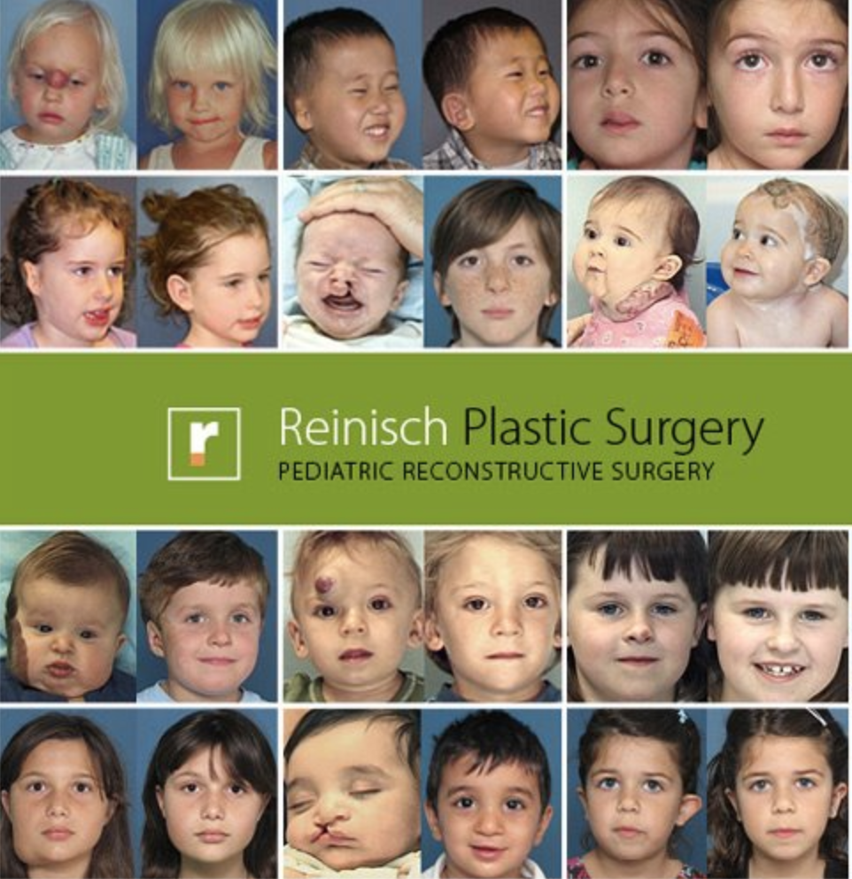 Cirugía Reconstructiva infantil