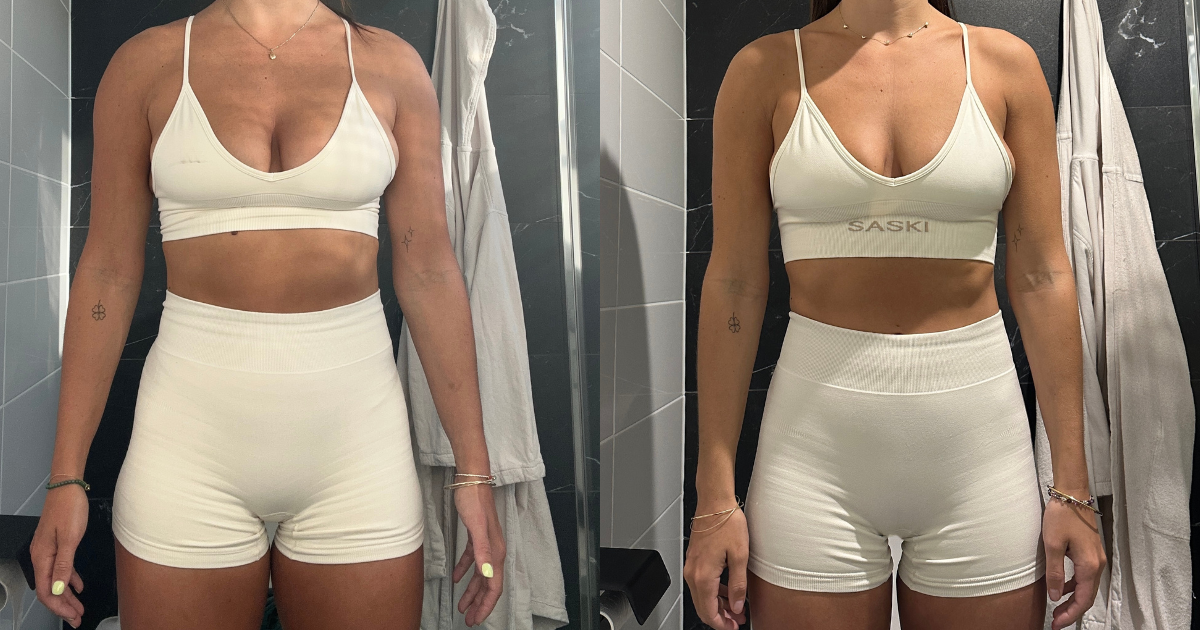 I tried retatrutide: and it wasn't just the weight loss that that surprised me