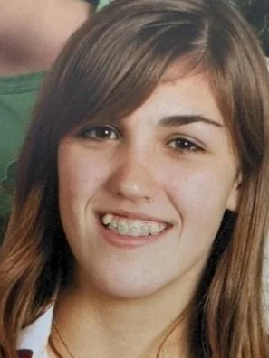 health coach kait before jaw surgery