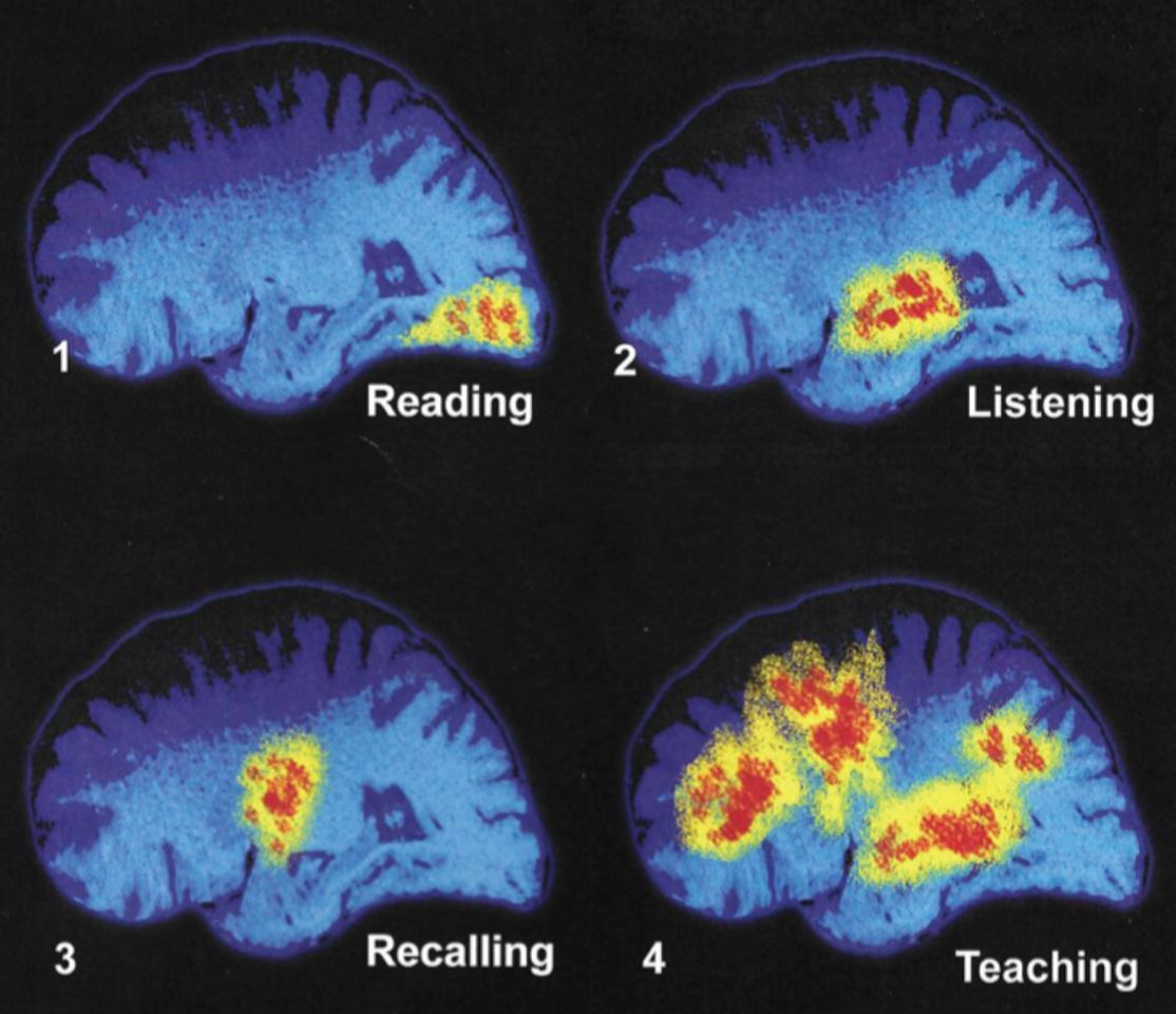 BrainLearning.png