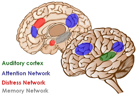 Brain Networks Involved in Tinnitus modified from Phantom percepts: tinnitus and pain as persisting aversive memory networks. De Ridder et al., 2011