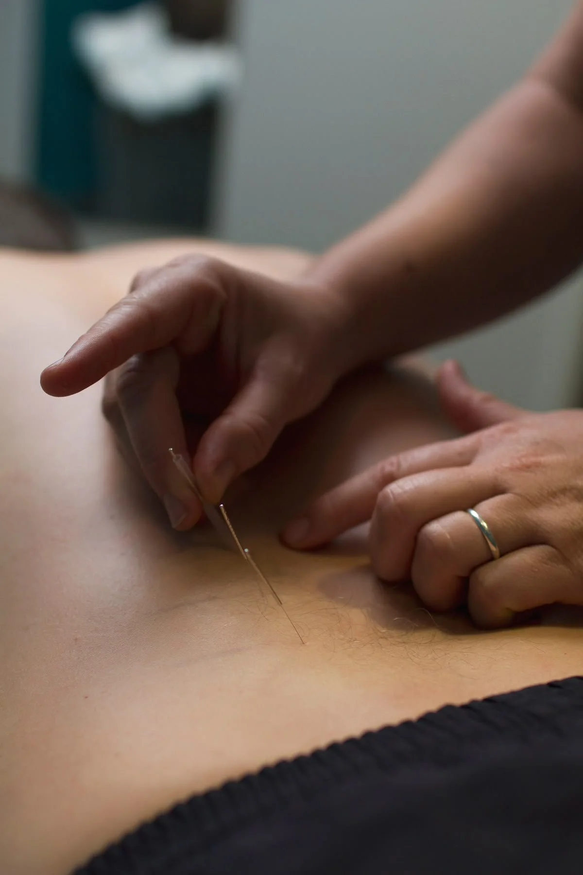 Acupuncture Session 45min