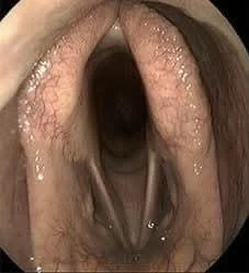 What’s that noise? Pt. 2