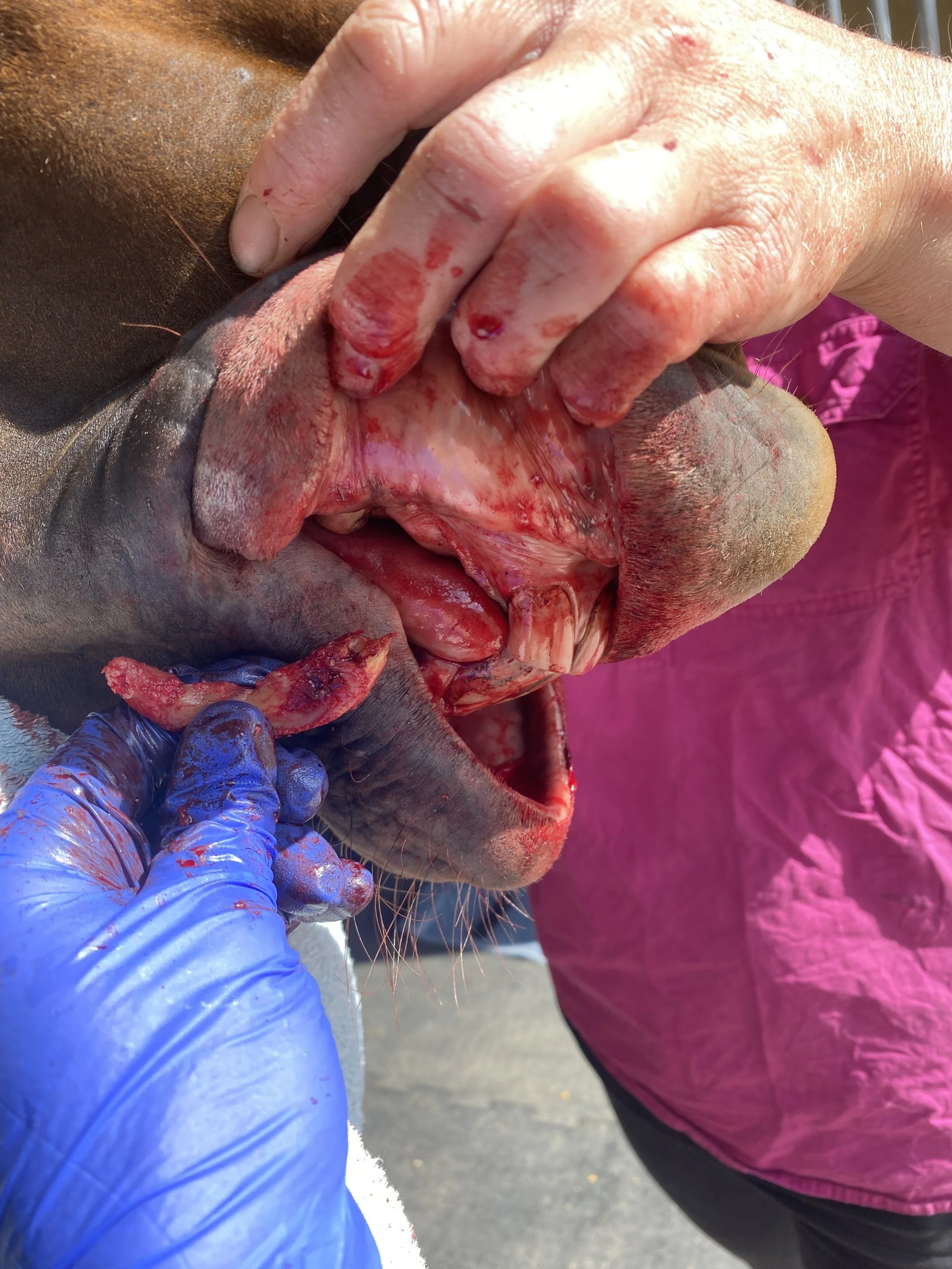 Canine Teeth/Extraction