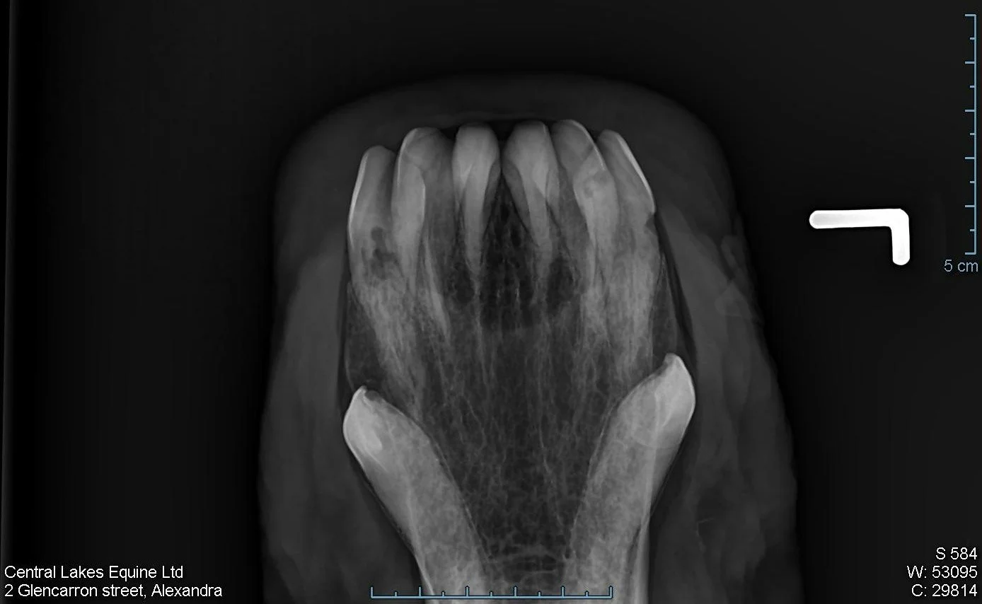 Importance of Radiographs 