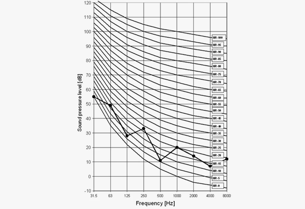 Common mistakes in DIY acoustics