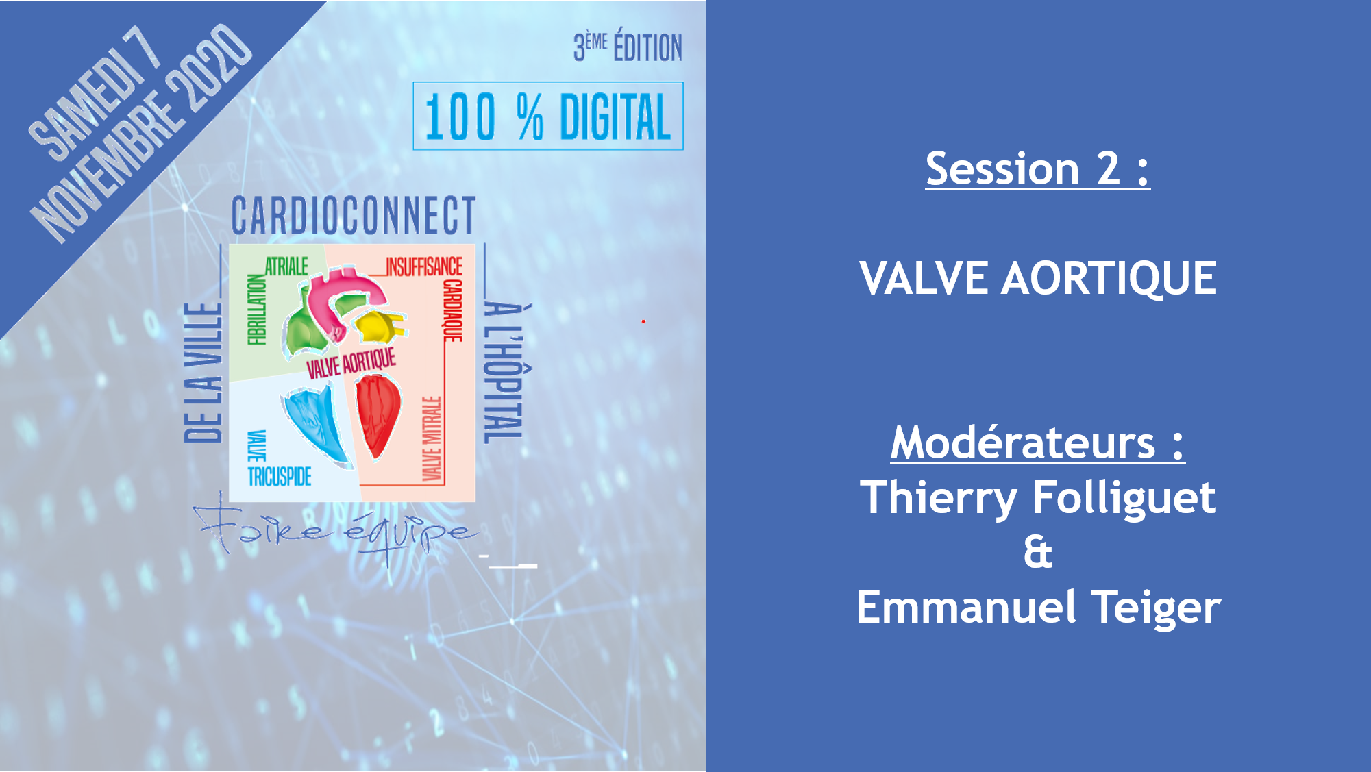 Session 2 : Valve Aortique