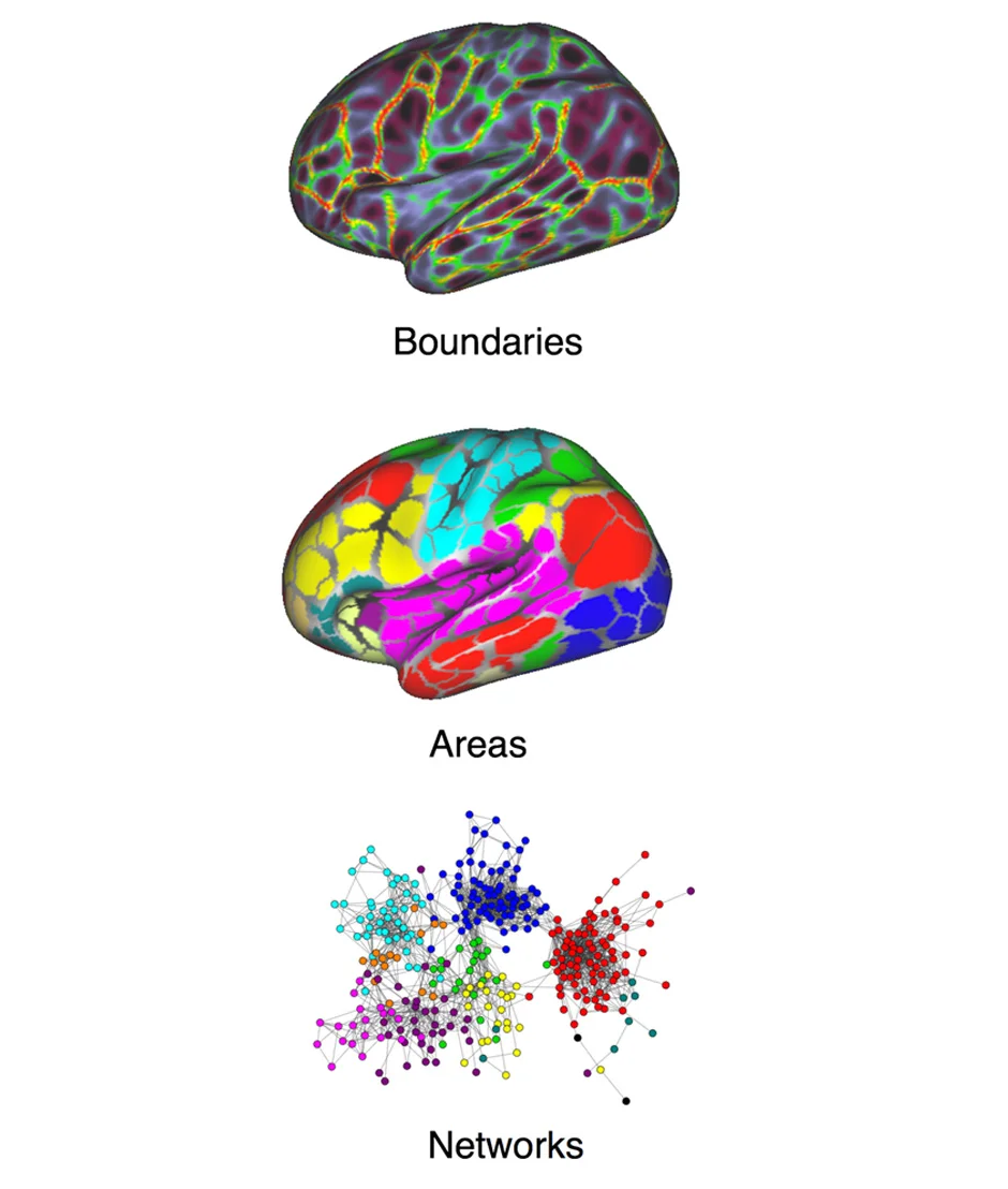 Research — Wig Neuroimaging Lab