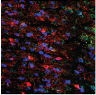 Stain of all neurons (blue), inhibitory neurons (red), and sphingosine-1-phosphate receptor 3 (green)