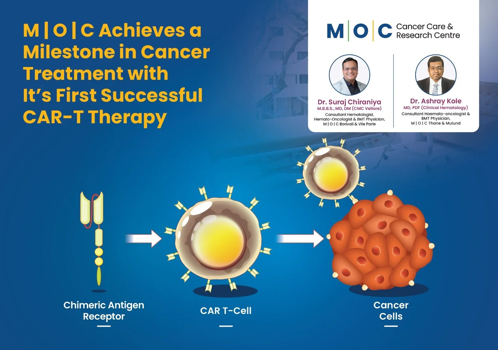 M | O | C Cancer Care Achieves Milestone with First Successful CAR-T Therapy