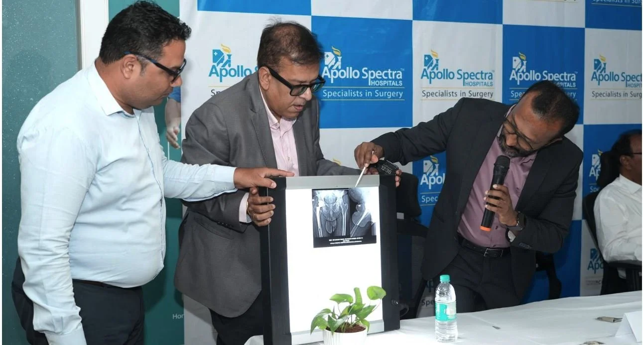 Apollo Spectra Redefines Hip Replacement Surgery with Cutting-Edge Precision and Expertise