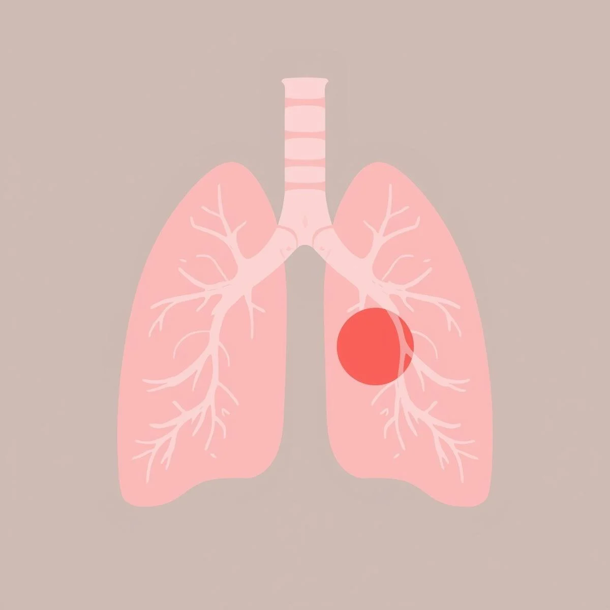 Yashoda Hospital Hitech City &amp; Qure.ai Launch AI-Enabled Lung Nodule Clinic for Early Lung Cancer Detection
