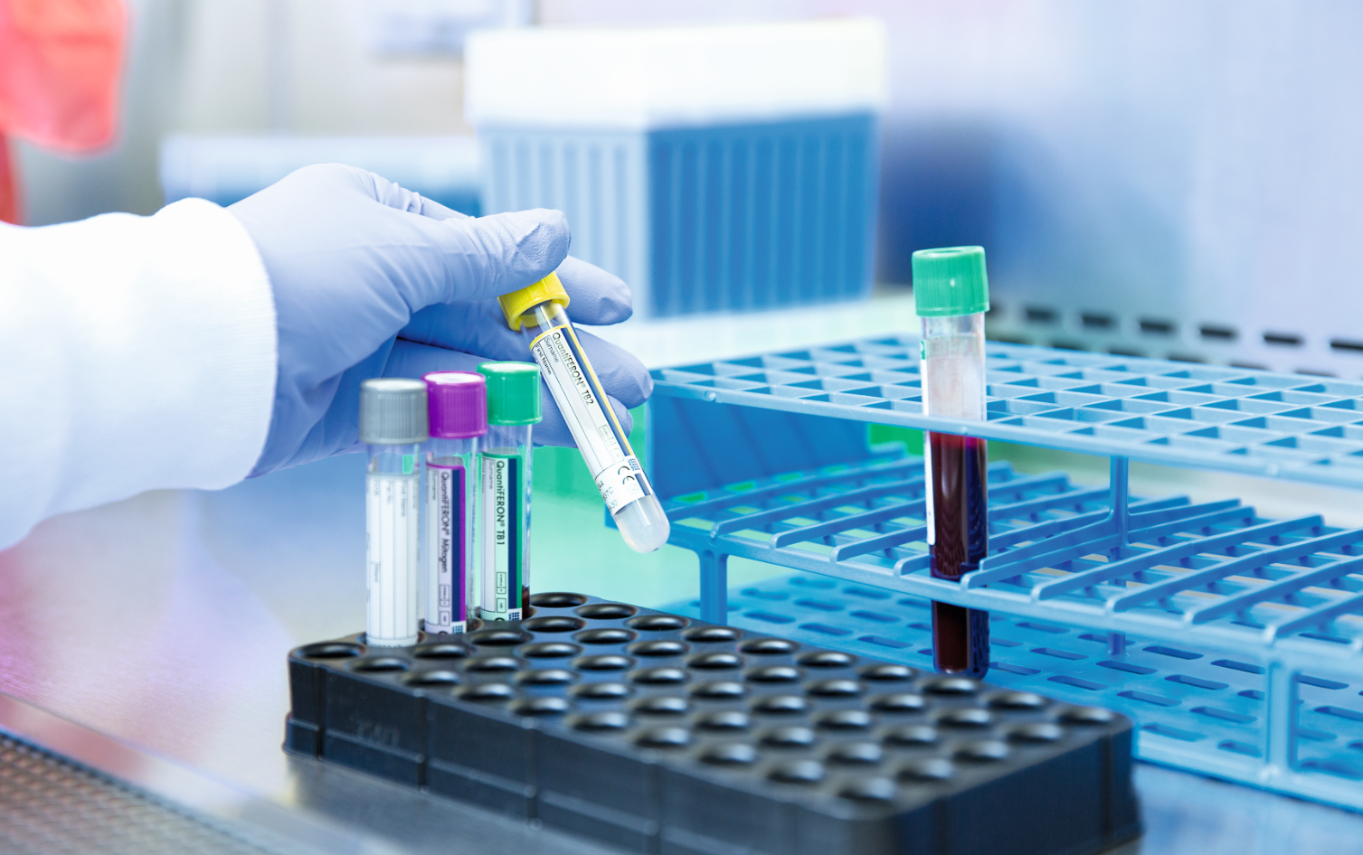 QIAGEN’s QuantiFERON-TB Gold Plus shows cost-effectiveness compared with TST in a newly published study in people with HIV