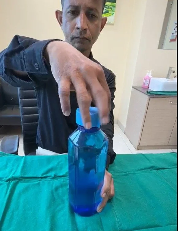 Gleneagles Hospital Restores Hand Function in Engineer Through Advanced PIP Joint Replacement