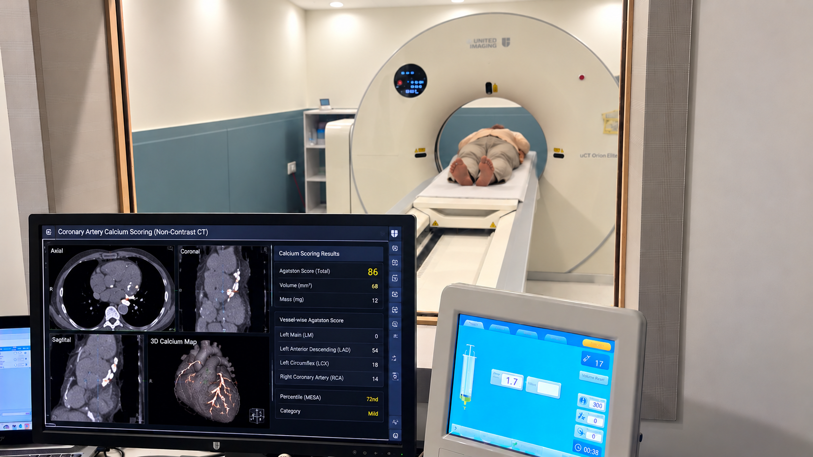 India’s First uCT Orion Elite CT Scanner with Calcium Scoring Comes to Delhi by City Imaging &amp; Clinical Labs