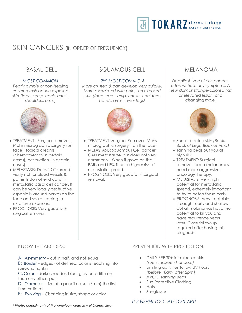 Skin Cancers &amp; Prevention