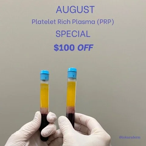 Why not use your own Blood to help fight the signs of Aging!!! PRP (platelet rich plasma) will help with under-eye dark circles, diminish fine lines &amp; wrinkles,  promote healing, and stimulate collagen production! 
SAVE $100 NOW&hellip;