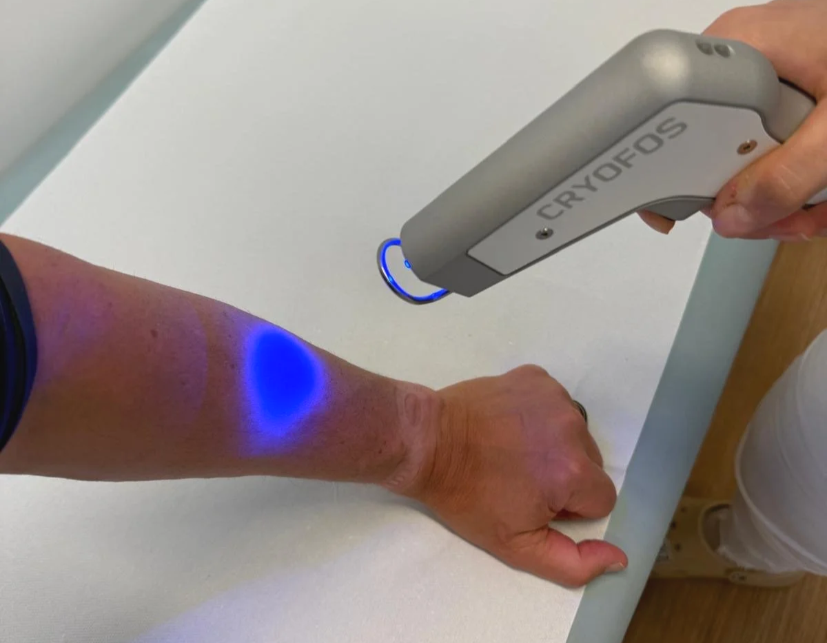 Die Kraft der Kälte: Kryotherapie zur schnellen Linderung von Schmerzen