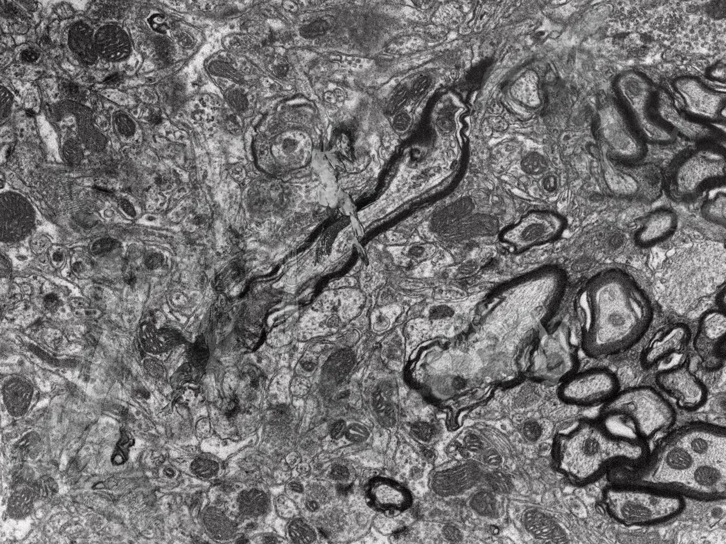 The comming age of military neuroscience (video)