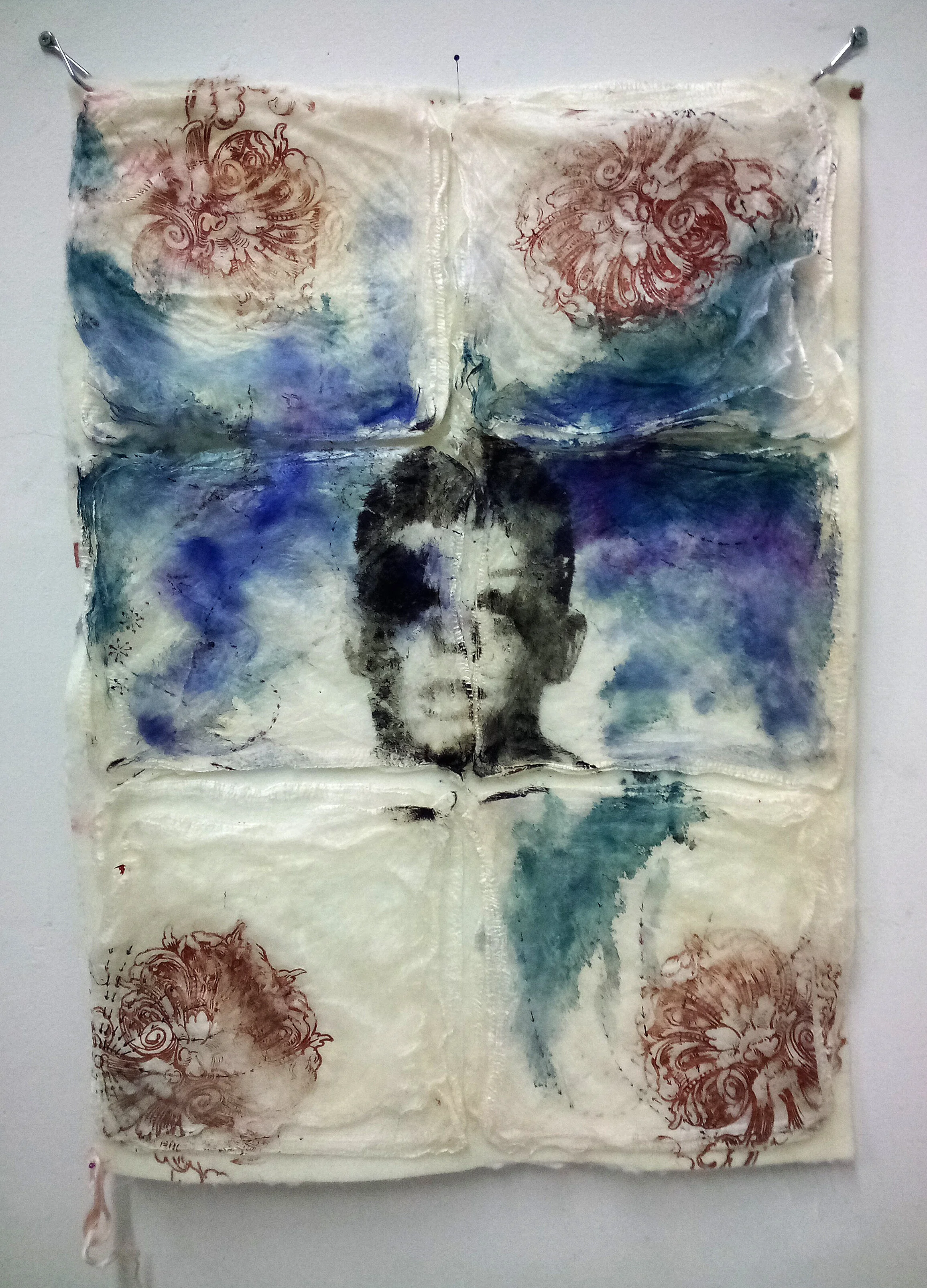 Lobotomy kid 01. (Guttenberg prints from the Asylum series). (2021)