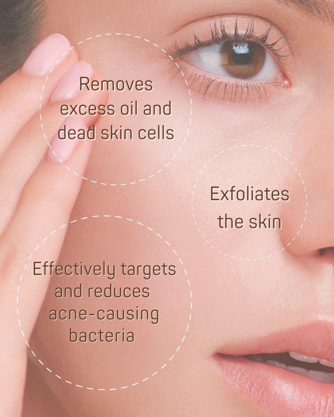 ✅ Breakouts
✅ Acne
✅ Blackheads
✅ Oily Skin
✅ Congestion
✅ Backne

Look for products containing bacteria fighting ingredients like Salicylic Acid

Salicylic acid treats multiple forms of acne and delivers superior preventative benefits.