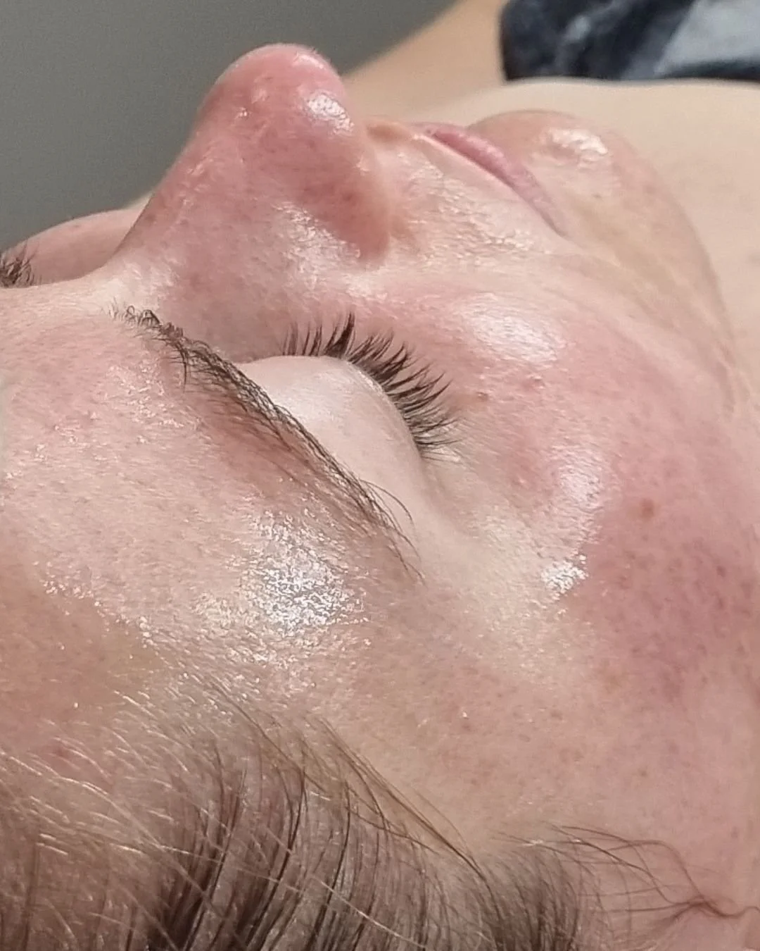 Are you looking for a way to get smoother, softer skin?

Epidermal levelling aka Dermaplaning is the perfect solution!

This non-invasive treatment works to remove the outermost layers of the epidermis as well as removing fine vellus hair (that peach