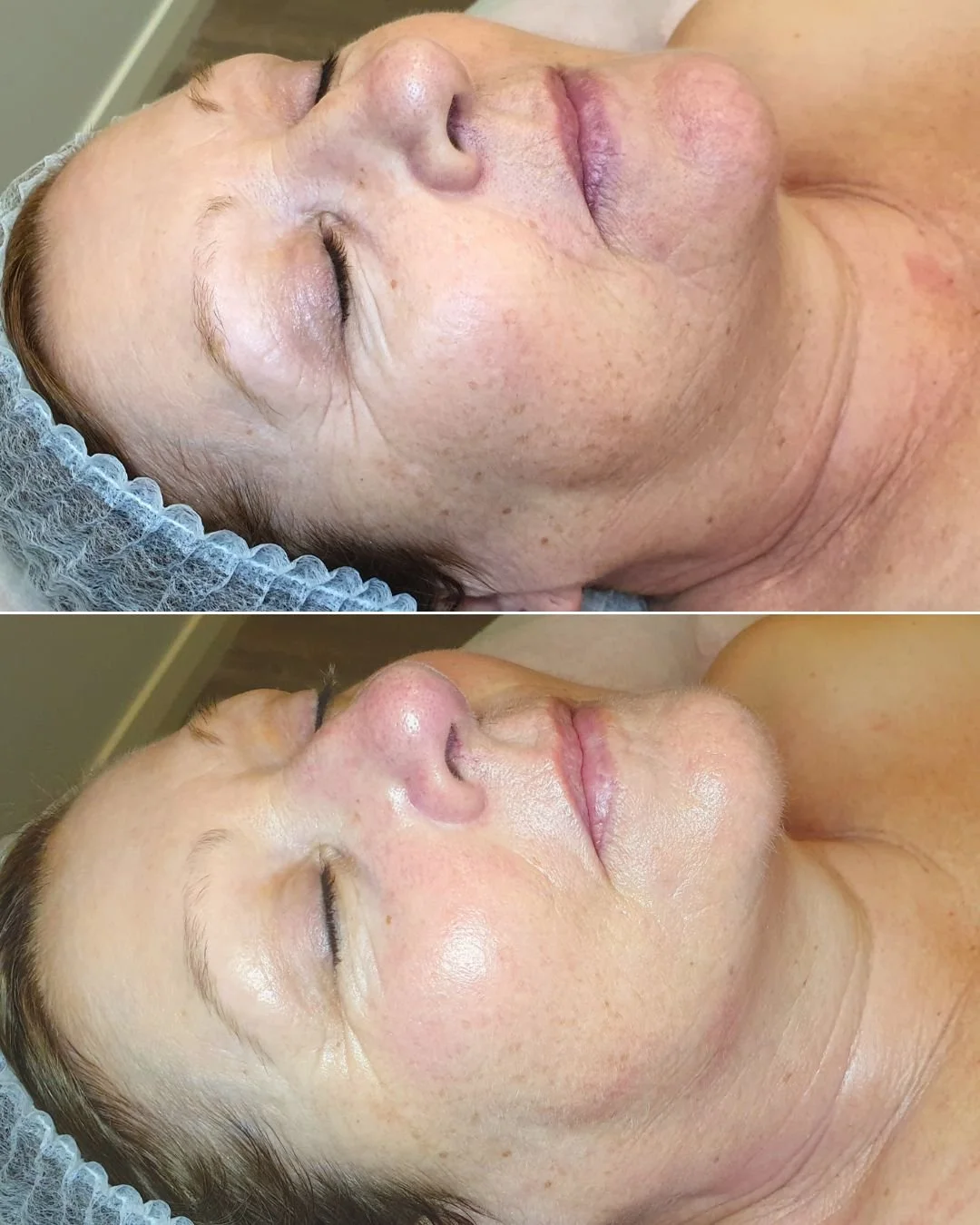 Who's ready to glow like never before?

Say goodbye to complicated treatments and hello to an instant skin lift with our Ultimate Age Defying Facial! Why&rsquo;s it a fan favorite? Let&rsquo;s dive in!

First off, it&rsquo;s all about the **science**