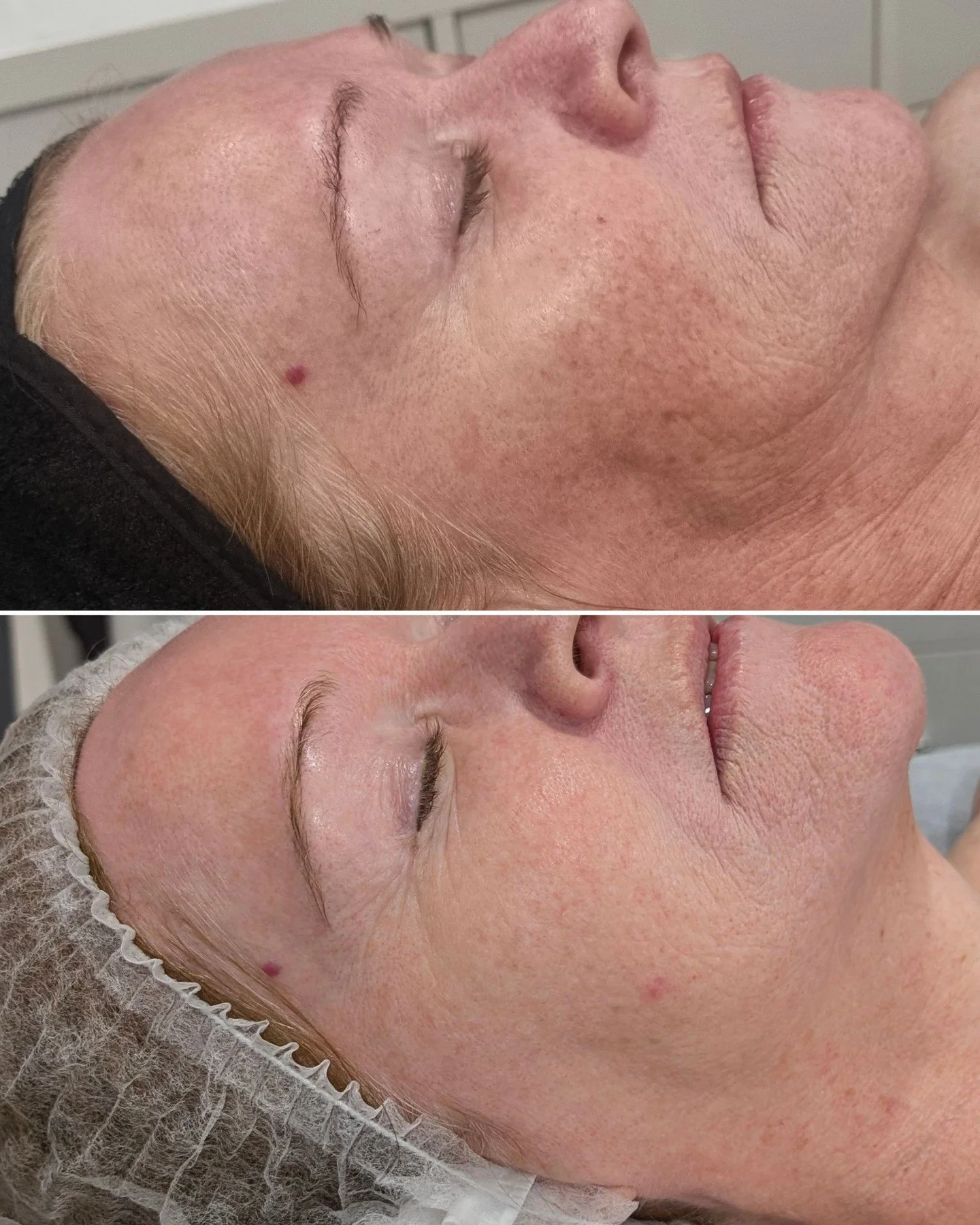 Your best skin starts here.

Book in with one of passionate skin experts and watch the magic happen 🧚

#skintherapist #skincaretreatments #perthskinclinic #skintreatments #skinclinicperth #skintreatmentsperth #skinrejuvenationclinic #beautifulskinst