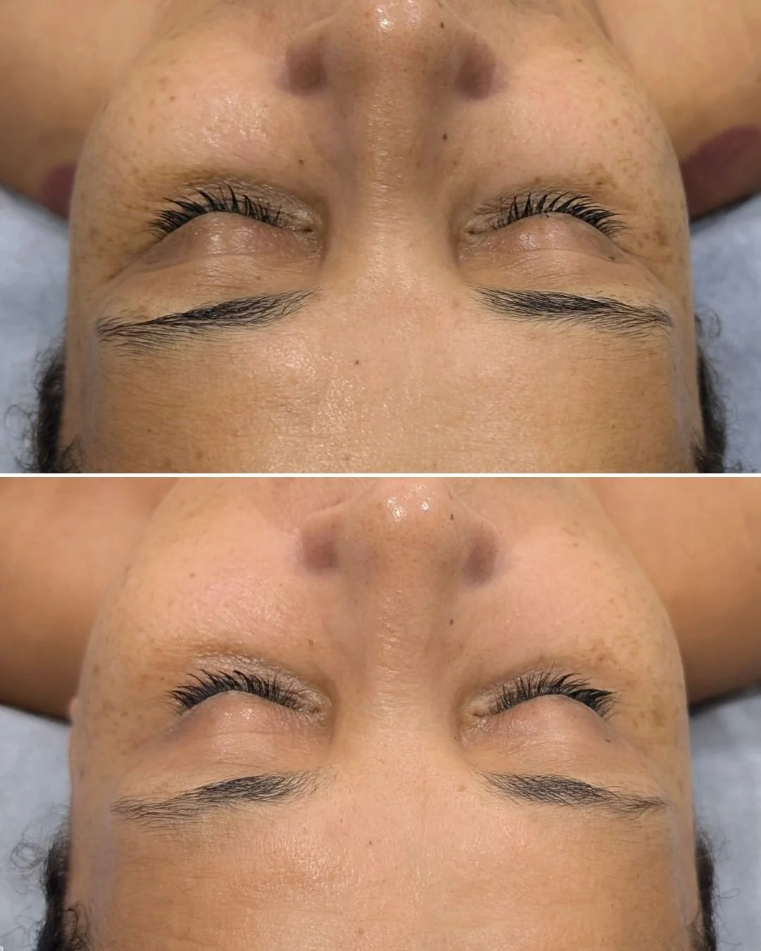 Geneo Illuminate Treatment

Best for pigmented skin, Geneo Illuminate unifies skin tone, improves pigmentation and rejuvenates the skin for a smoother complexion.

Packed full of active ingredients such as:
🍊VITAMIN C
🍄KOJIC ACID
🥕CARROT EXTRACT
?