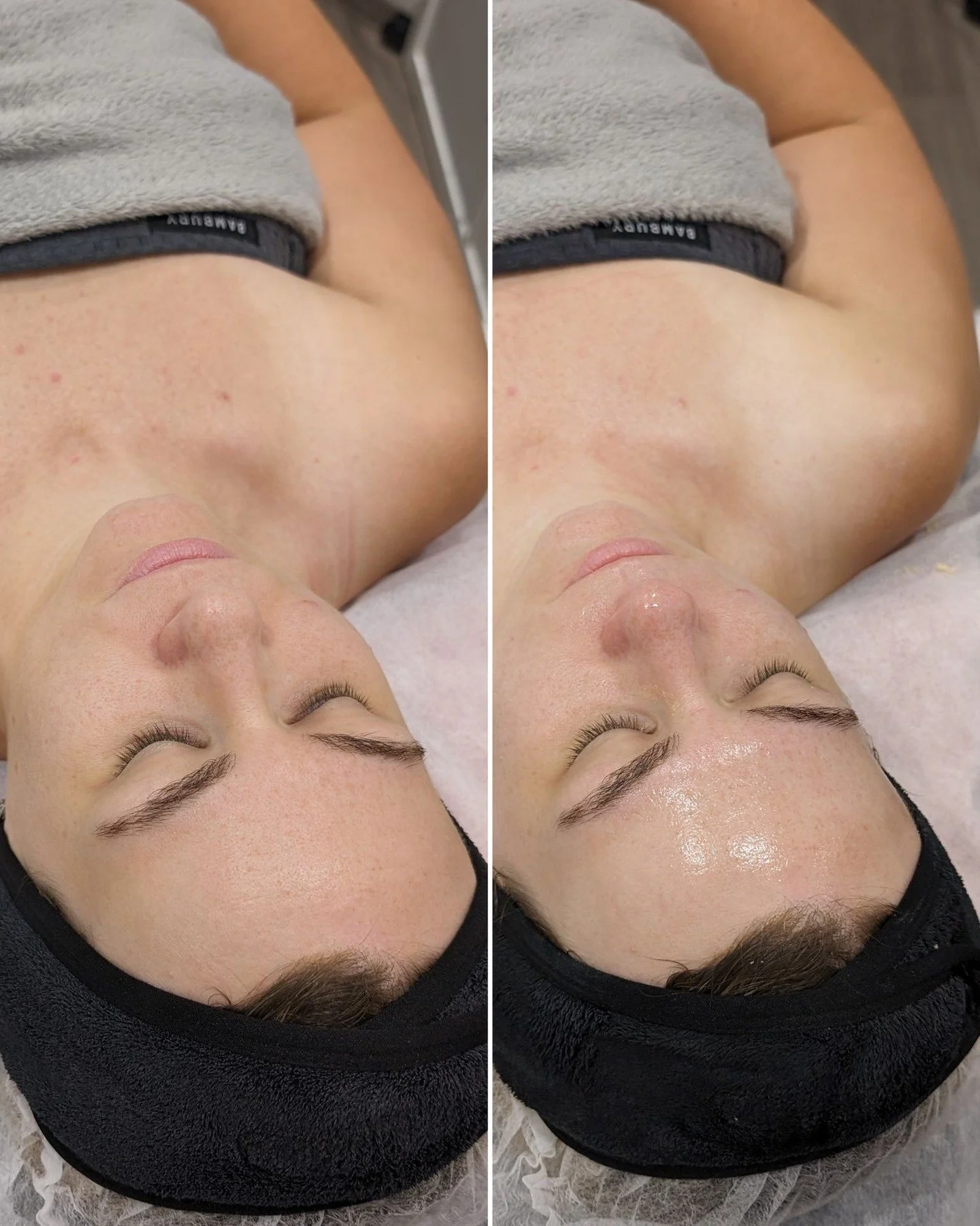 💫 Pro Dermal Active 💫

O Pro Dermal Active (PDA) embraces the power of science and skin physiology to support skin health, rejuvenation, and glow!

This customisable skin treatment works to support cellular oxygenation and the skin&rsquo;s microbio