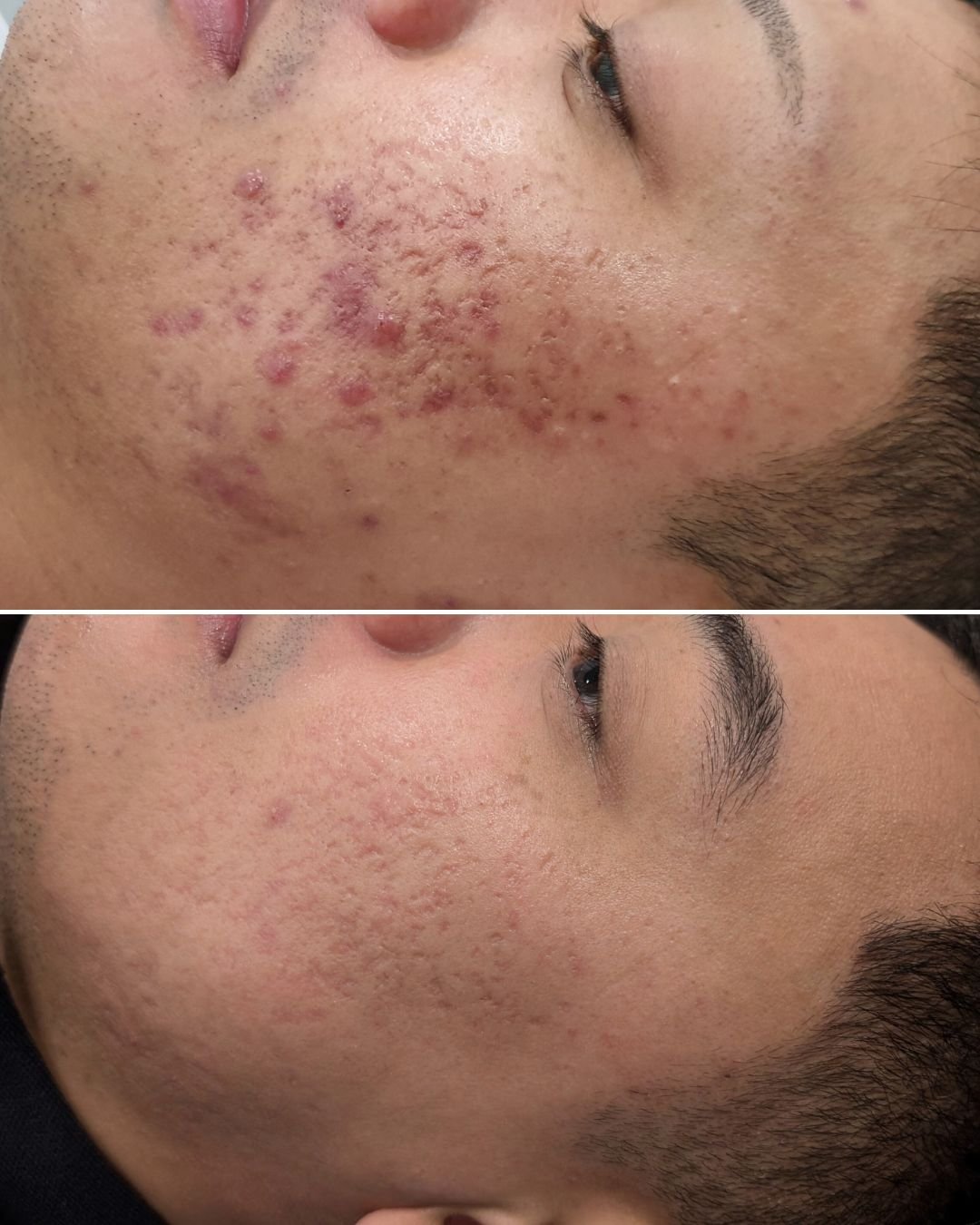 ✨ Feeling uncomfortable in your own skin? You're not alone! 😔 If you've tried everything but still struggle with achieving that healthy, glowing look, guess what? You've landed in the right place! We&rsquo;re absolutely passionate about skin care an