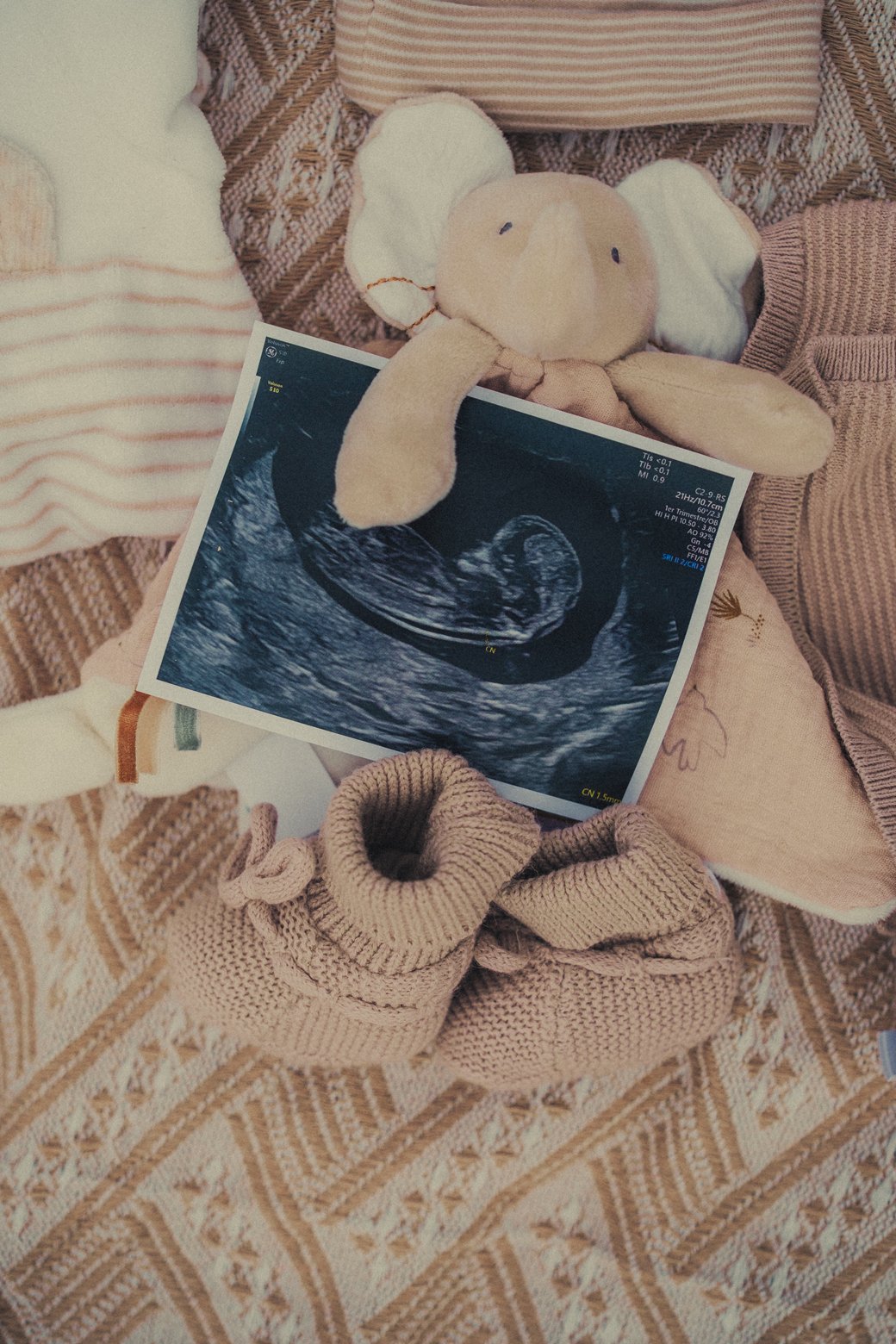 photographe de grossesse à Roanne