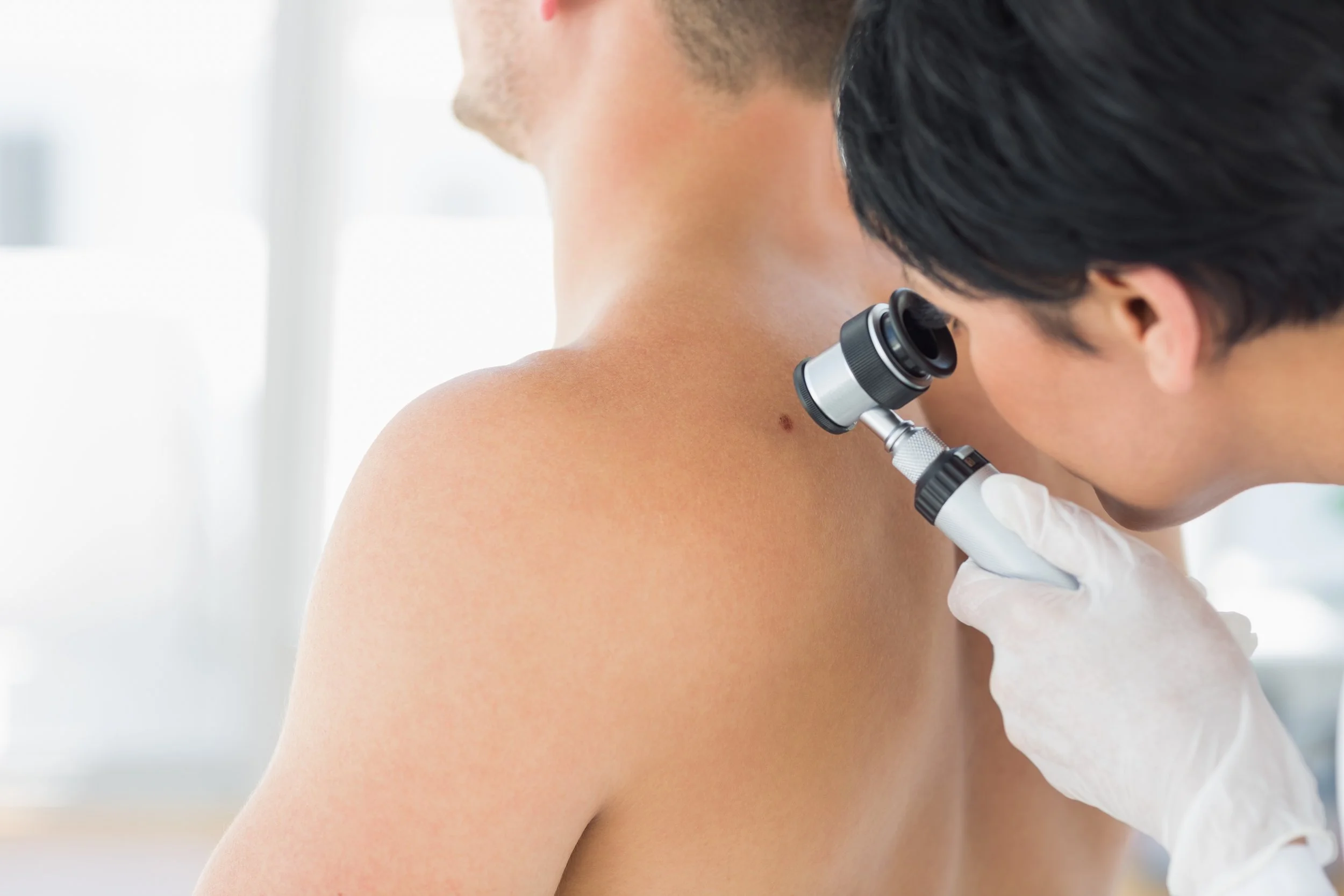 dermatoscope.jpeg