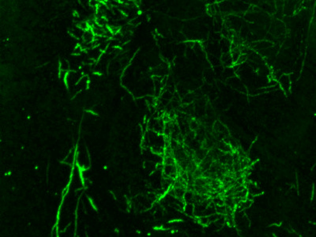 iDISCO_axons_green.jpg