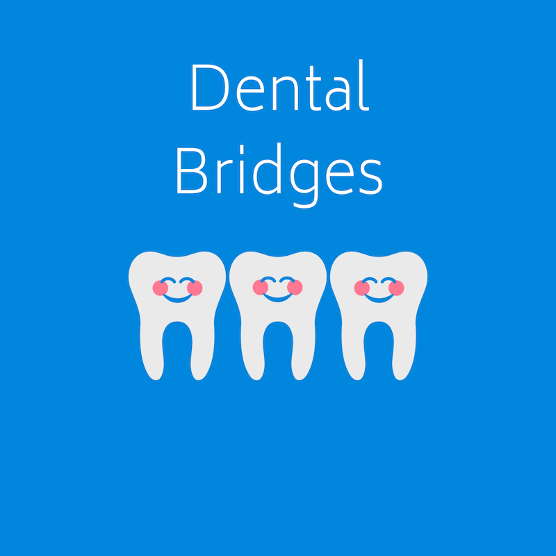 Dental Bridges at West Ridgewood Dental Professionals - Best Dental Bridge Dentists in Bergen County New Jersey (11)