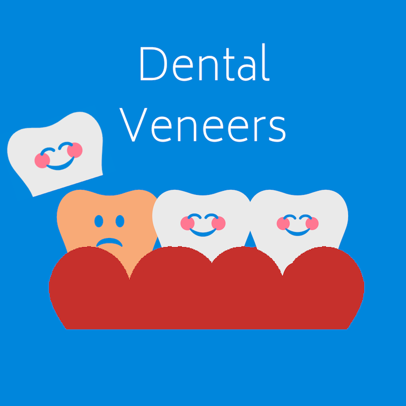 Dental Veneers at West Ridgewood Dental Professionals - Best porcelain Veneer Dentists in Bergen County New Jersey