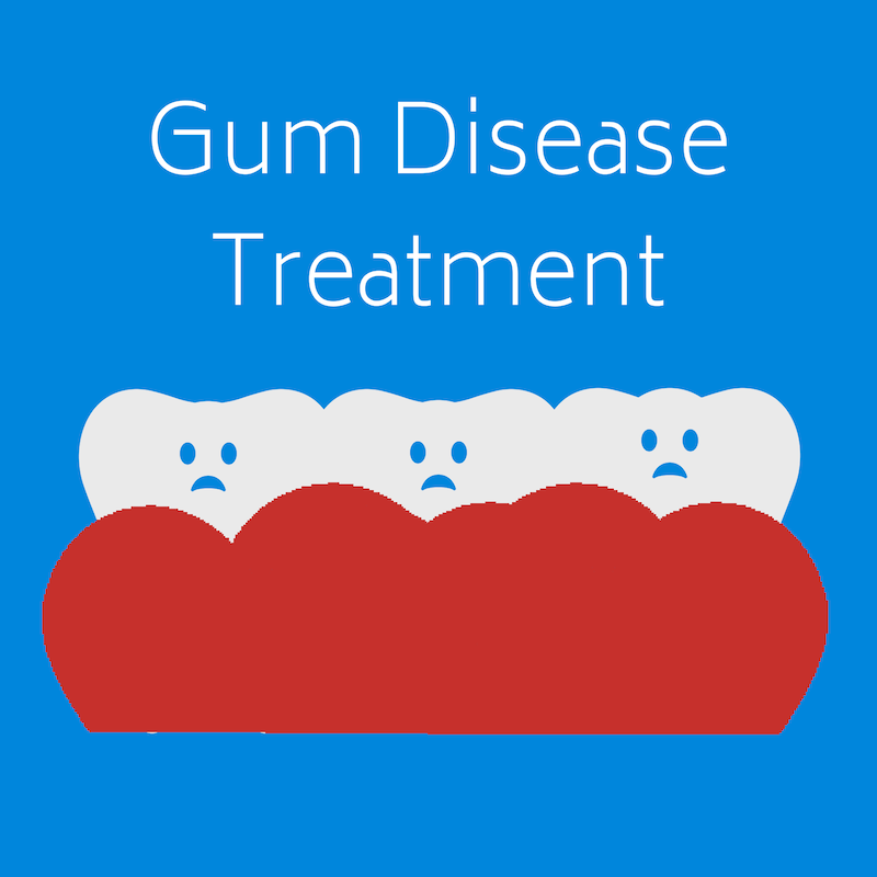 Gum Diseas Treatment at West Ridgewood Dental Professionals - Best Gum Disease Dentists in Bergen County New Jersey (18)