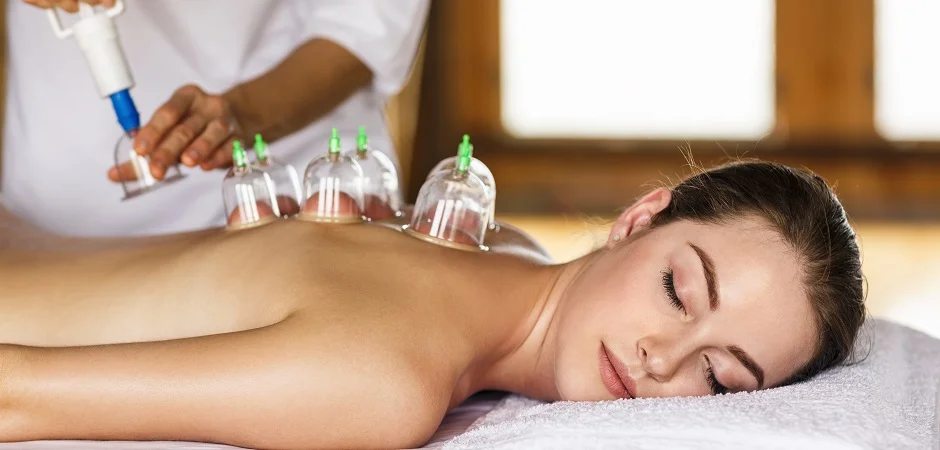 cupping5.jpg