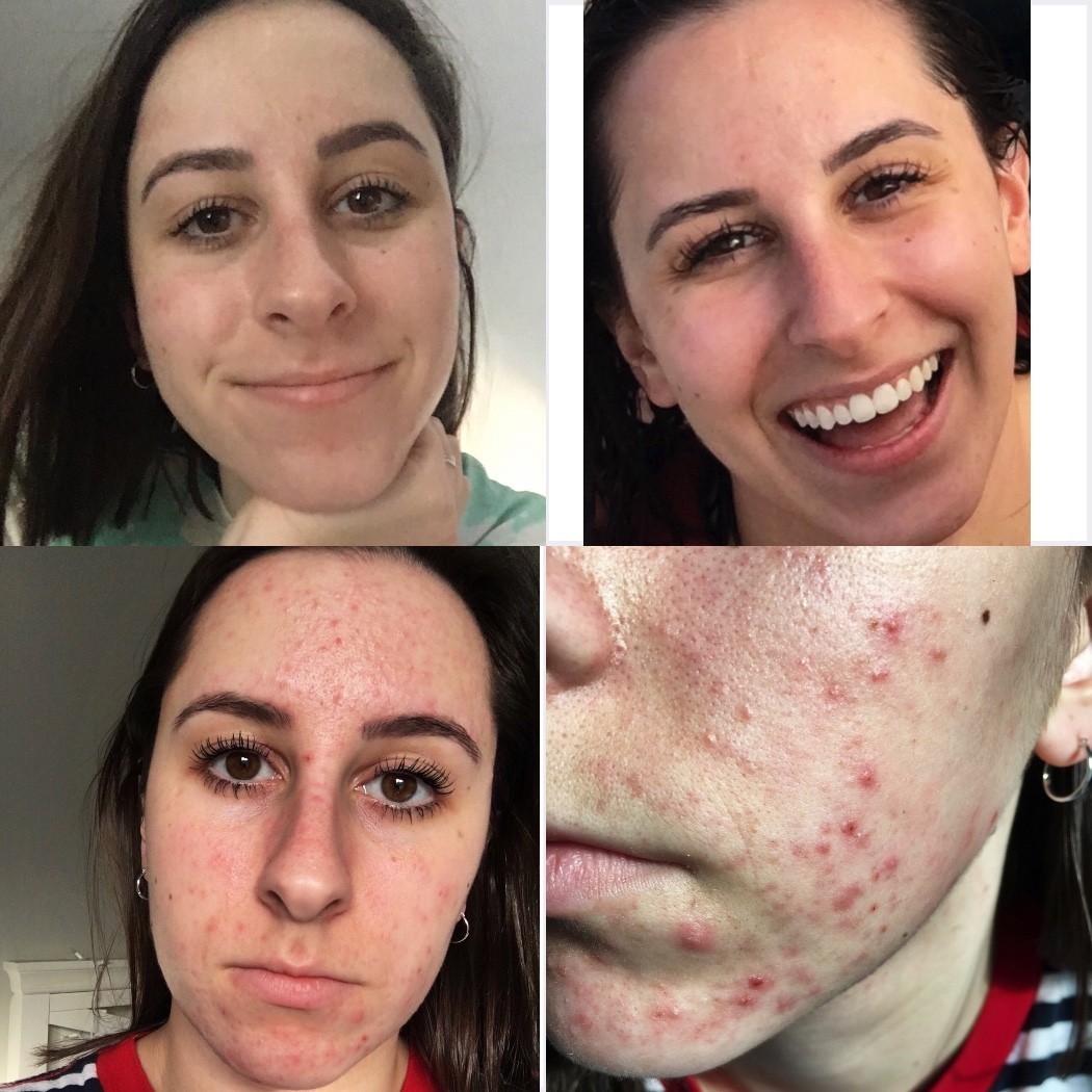 curology birth control