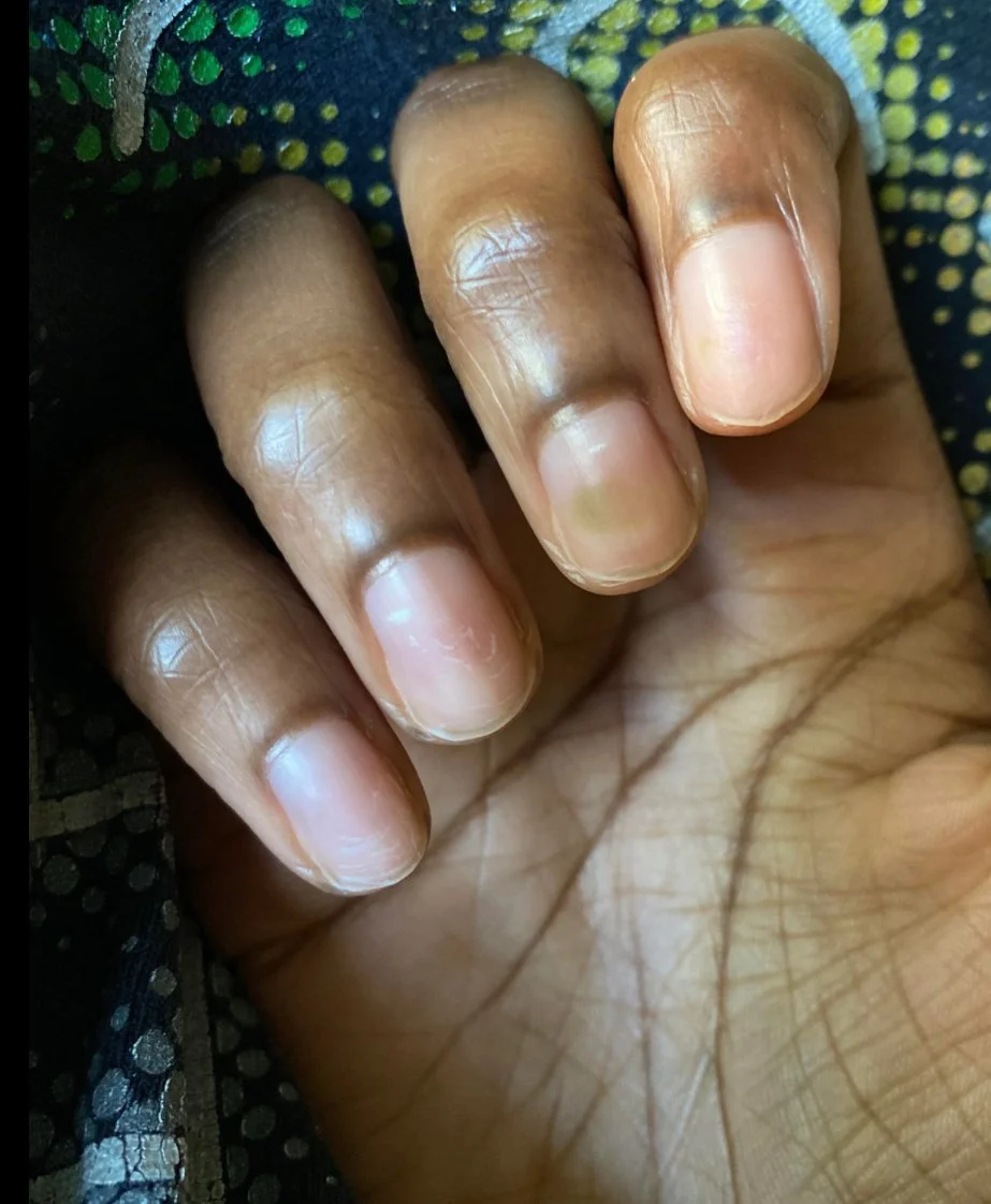 Greenies ON MY NAILS! HELP!