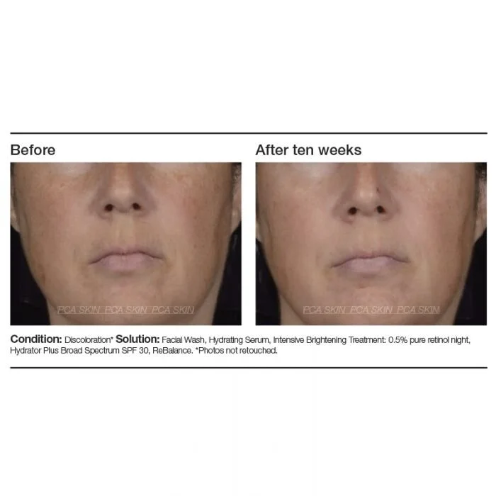 Pca Skin Facial Wash Cleanse Face Body Bar Gilbert Az