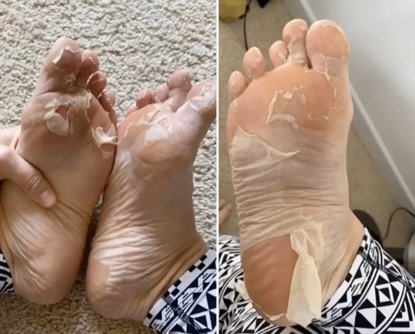 Patchology Poshpeel Pedicure Cleanse Face Body Bar Gilbert Az