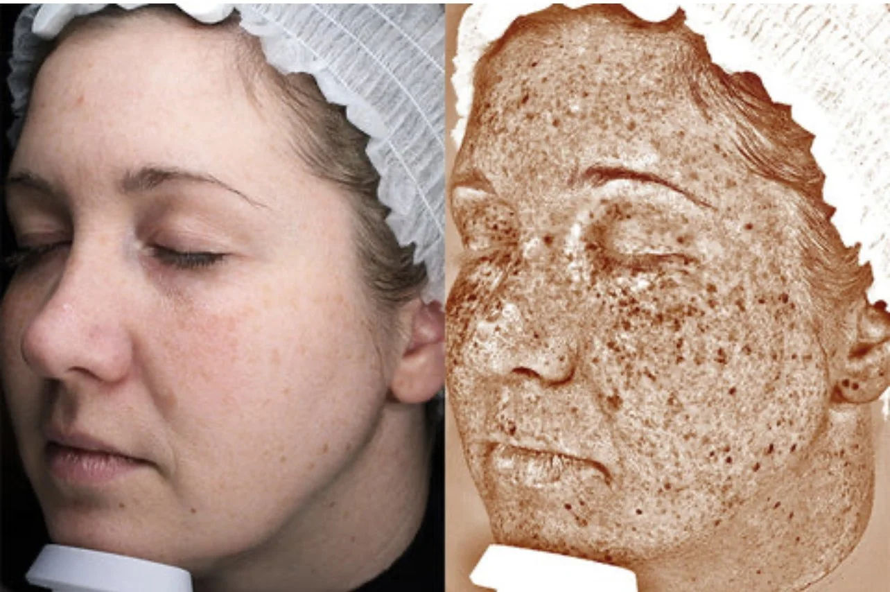 What does healthy Skin look like?