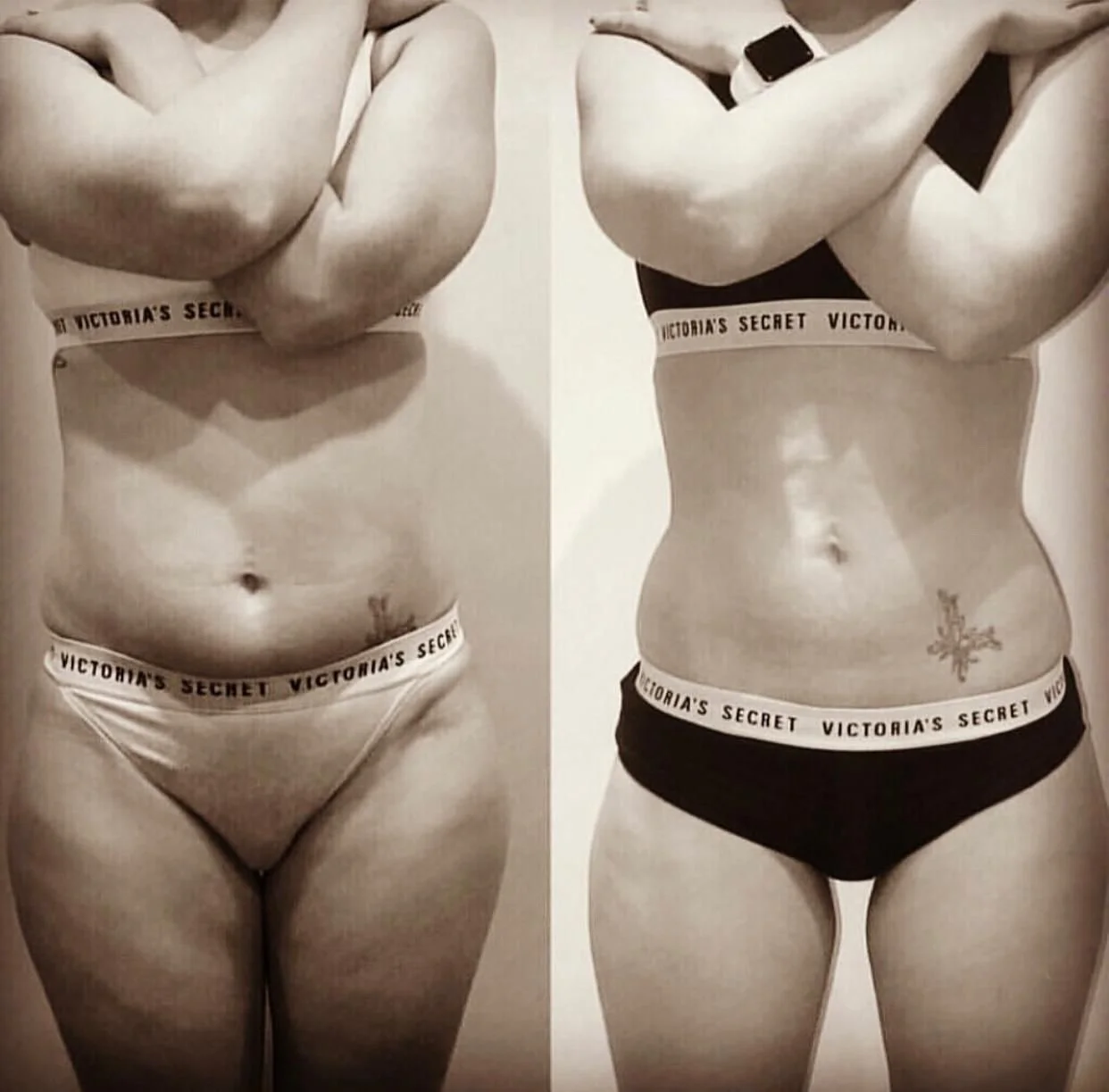 Discover the Transformative Power of CryoSkin at LondonCryo 