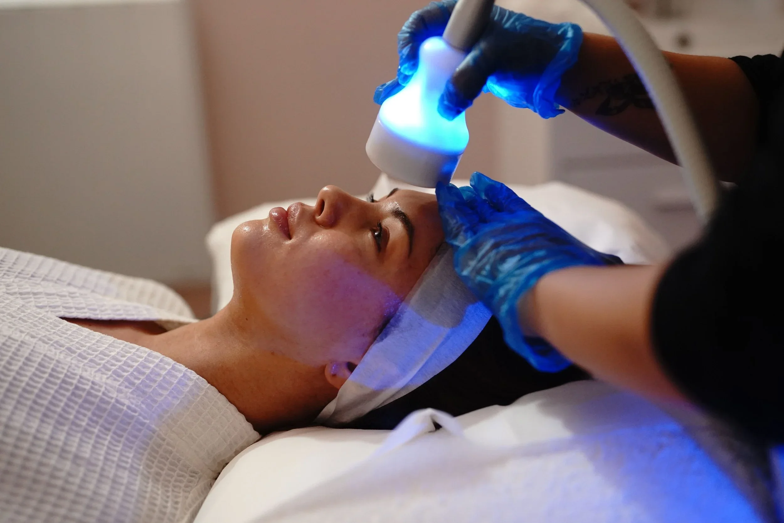 Cryofacial.webp