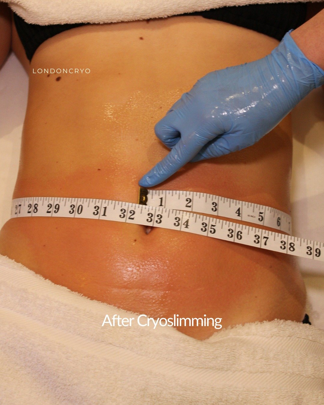 There&rsquo;s usually one area that just doesn&rsquo;t seem to change.. 

Even when everything else is moving in the right direction.

It&rsquo;s not about doing more, some areas are just more stubborn. This is where something more targeted can help.